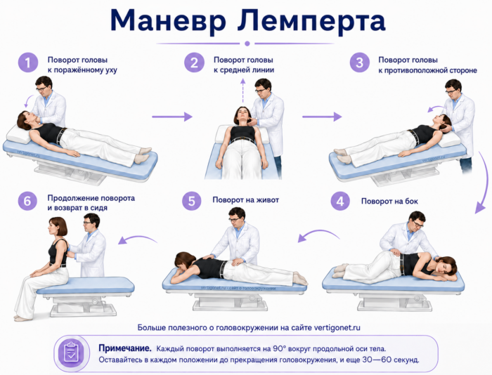 маневр лемперта при дппг
