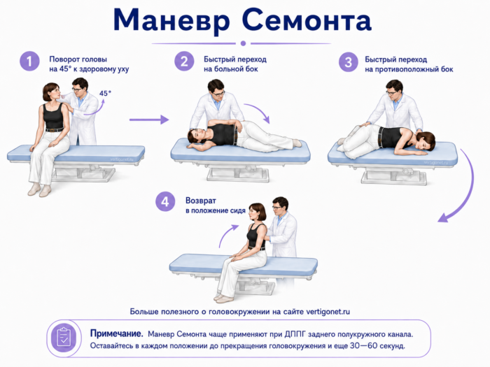 маневр семонта